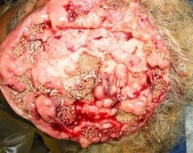 parazity v lidském mozku